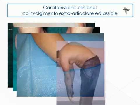 Il fufan un corpo pulito per comprare la lozione da psoriasi in Ekaterinburg Come guarire leczema su palme