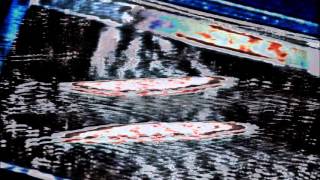 Subvoice - Vampirella (DBX insanelikecoltrane remix)
