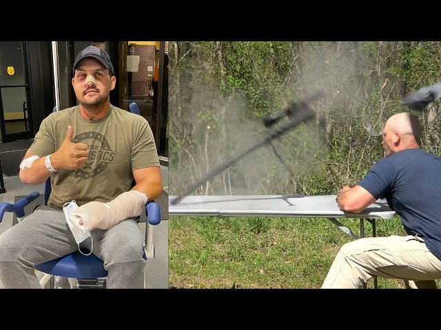 Who is Scott DeShields Jr? YouTuber left with punctured lung and hole