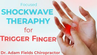 Shockwave Therapy &amp; Trigger Finger | ESWT for TENOSYNOVITIS RESEARCH