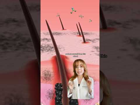 Why It's Important To Know About DHT 📝 #dhtblocker #dht #hairlosssolutions #hairscience