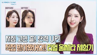 처음해보는 울쎄라리프팅 솔직후기