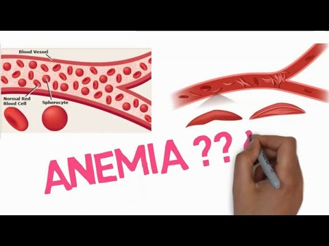 Apa itu anemia