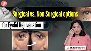Under Eye Aging Treatment | Non Surgical Eyelid Lift | Types of Eyelid Surgery | SB Aesthetics