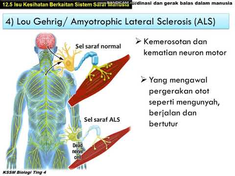 BIOLOGI TINGKATAN 4 : 12.5 ISU KESIHATAN BERKAITAN SISTEM SARAF MANUSIA