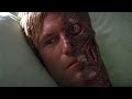Visiting Harvey Dent In The Hospital