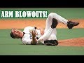 MLB ARM BLOWOUTS TERRIBLE ARM INJURIES 1080p HD