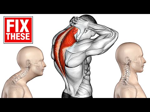 Exercising for Better Posture