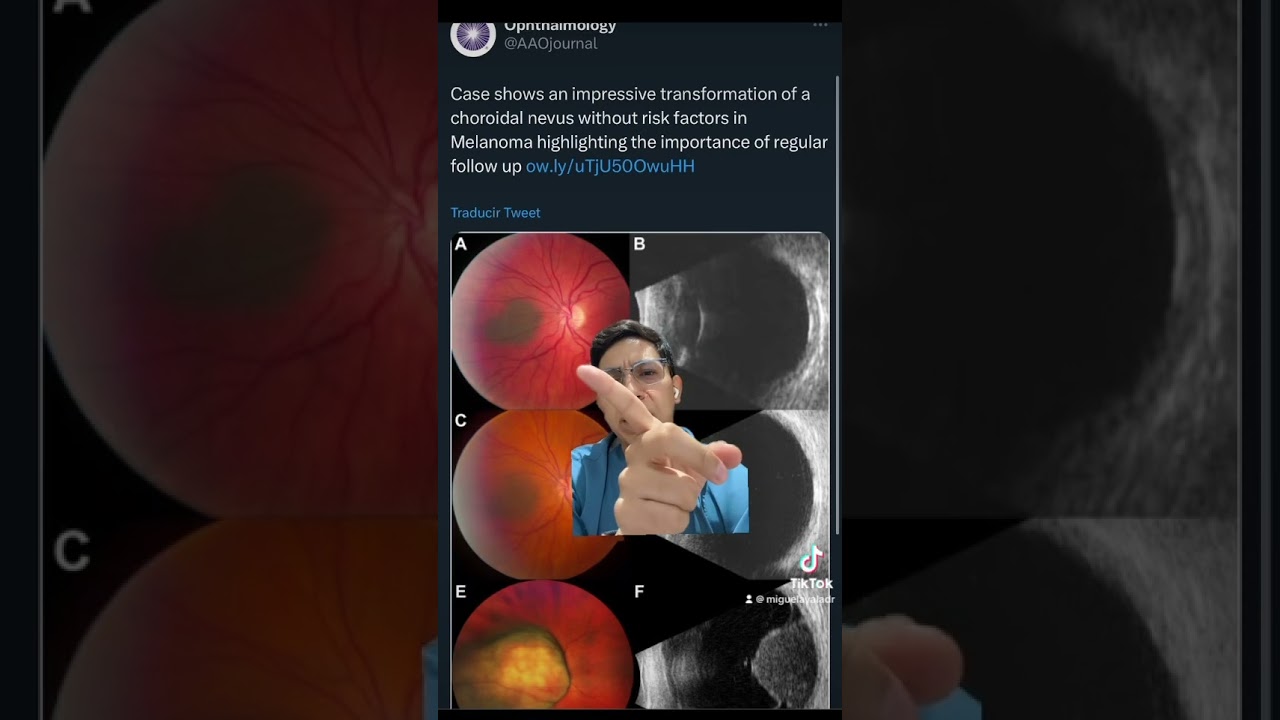 Miguel Ángel Ayala Hernández-14