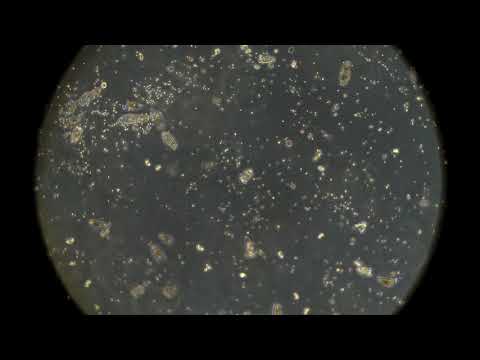 Вода из лесного озера под микроскопом MAGUS Bio V350