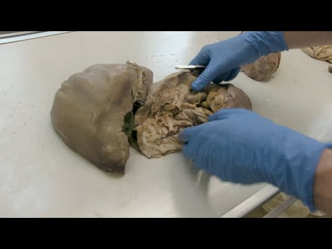 2 Fragen 1 Organ - Duodenum