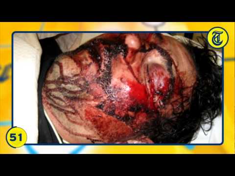 Nieuwsflits 15 Juni 2011 - Wie takelde Bart zo toe?