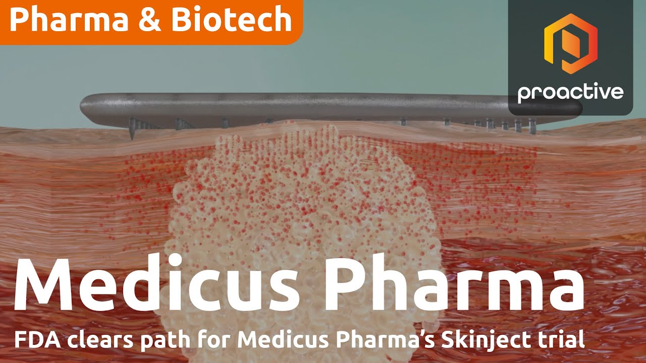 Medicus Pharma gets positive FDA feedback on Skinject microneedle therapy for basal cell carcinoma