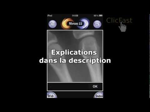 EnigmOn 2 IOS