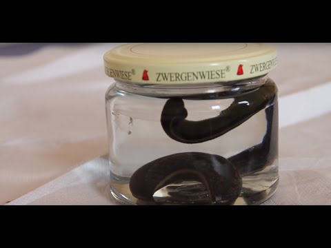 Psychogener Symptome von Rückenschmerzen Innerhalb der Gelenkbeschwerden