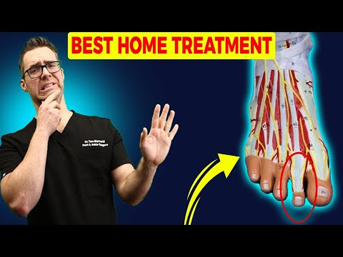 Heel Spurs Plantar Fasciitis BEST Home Treatment 2022
