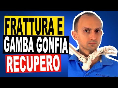 Lower Limb Fracture - Promoting Recovery