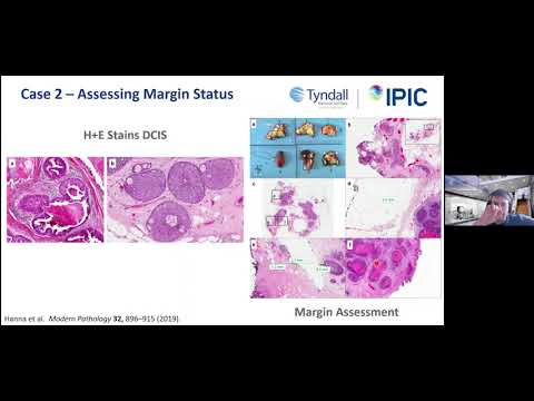 5. Clinical Applications of BioPhotonics - 2021 Biophotonics Workshop