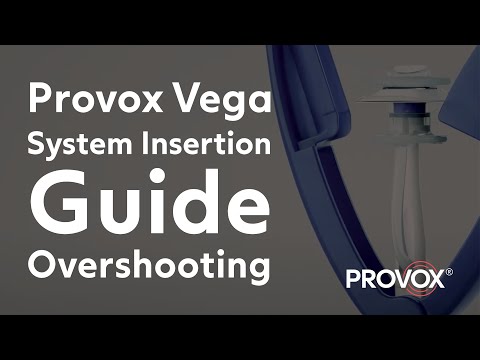 System Insertion Guide - Overshooting Provox® Vega™ and Provox® Vega™ XtraSeal™ | Atos Medical