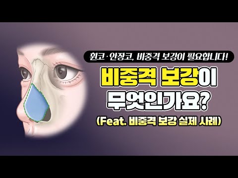 Q. 안장 코, 휜 코 재수술, '비중격 보강'은 대체 무엇인가요❓