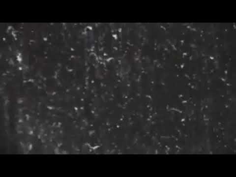 Reece McLachlan v Mikey Cheetam (MFA)