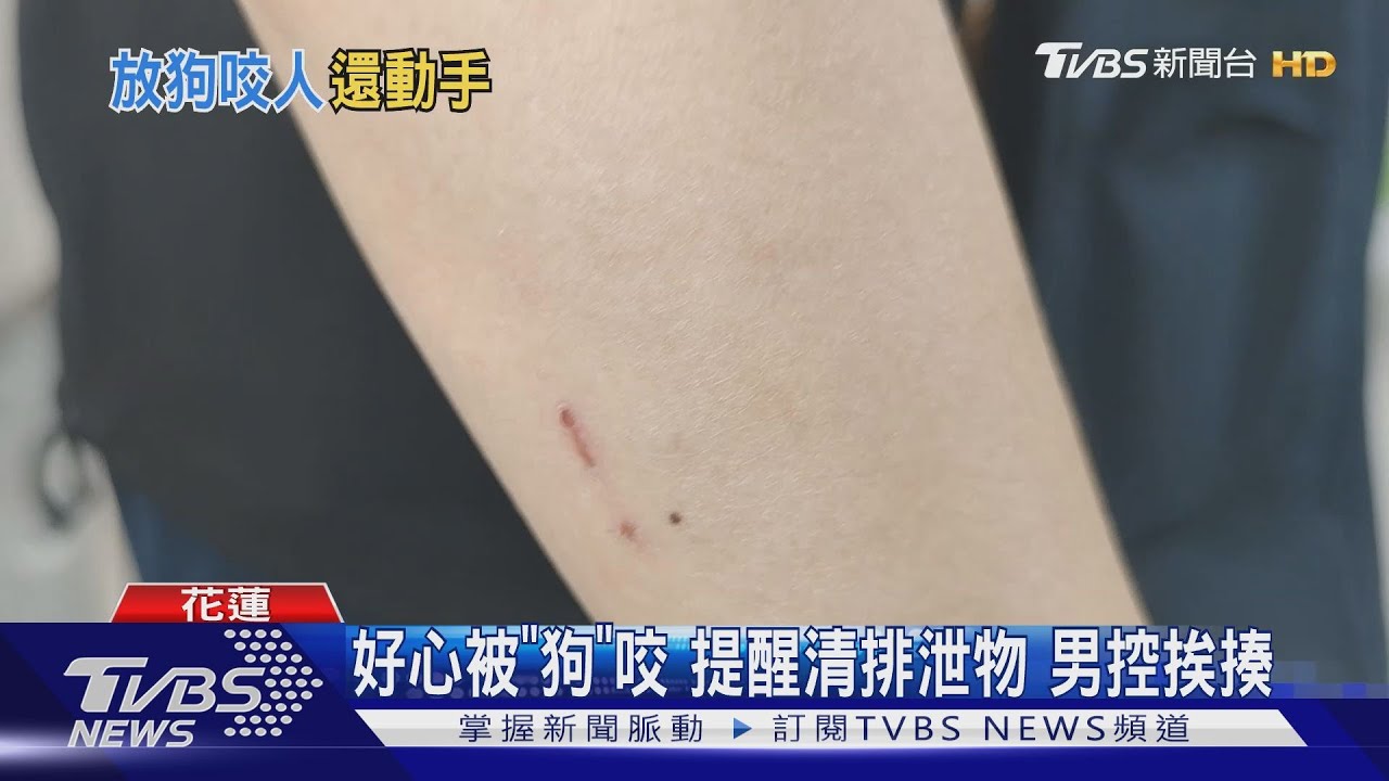 好心被「狗」咬 提醒清排泄物男控挨揍