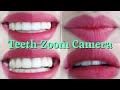 Teeth Zoom Camera And Smile Enjoy With MOHINI KI DUNIYA 143