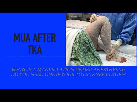 Manipulation Under Anesthesia (MUA) after Total Knee - Treatment for Stiffness