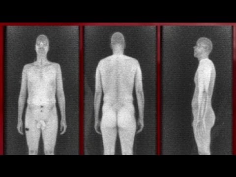 pourquoi les rayons x sont dangereux pour la santé