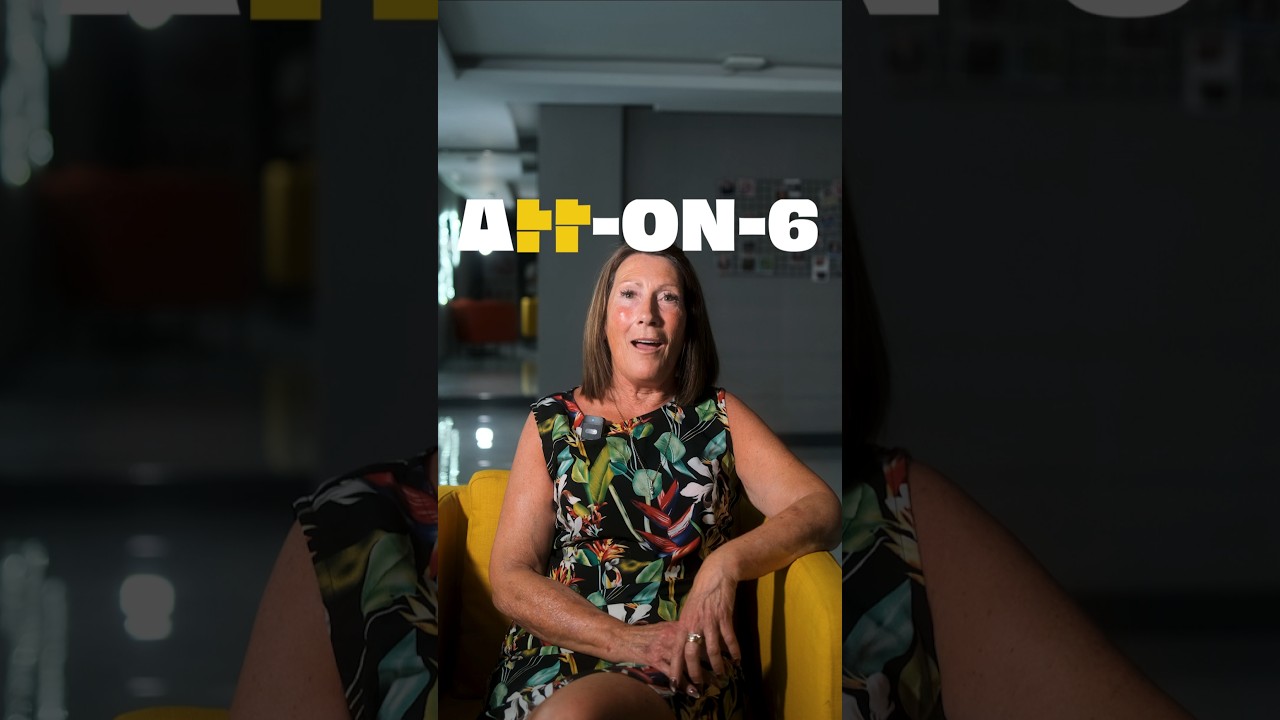 20 E-max Laminate Veneers – BL1 - Video