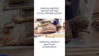 Cutting the human body into sections, sagittal section of female pelvis, anatomy museum #shorts