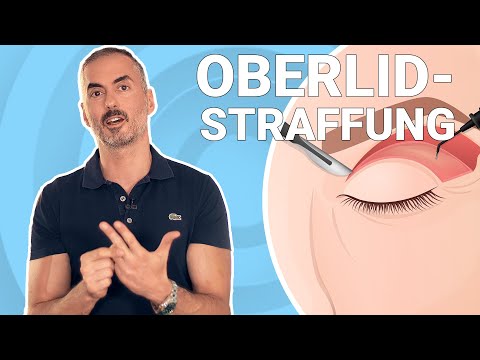 Dein Plastic Surgery Coach - Oberlidstraffung