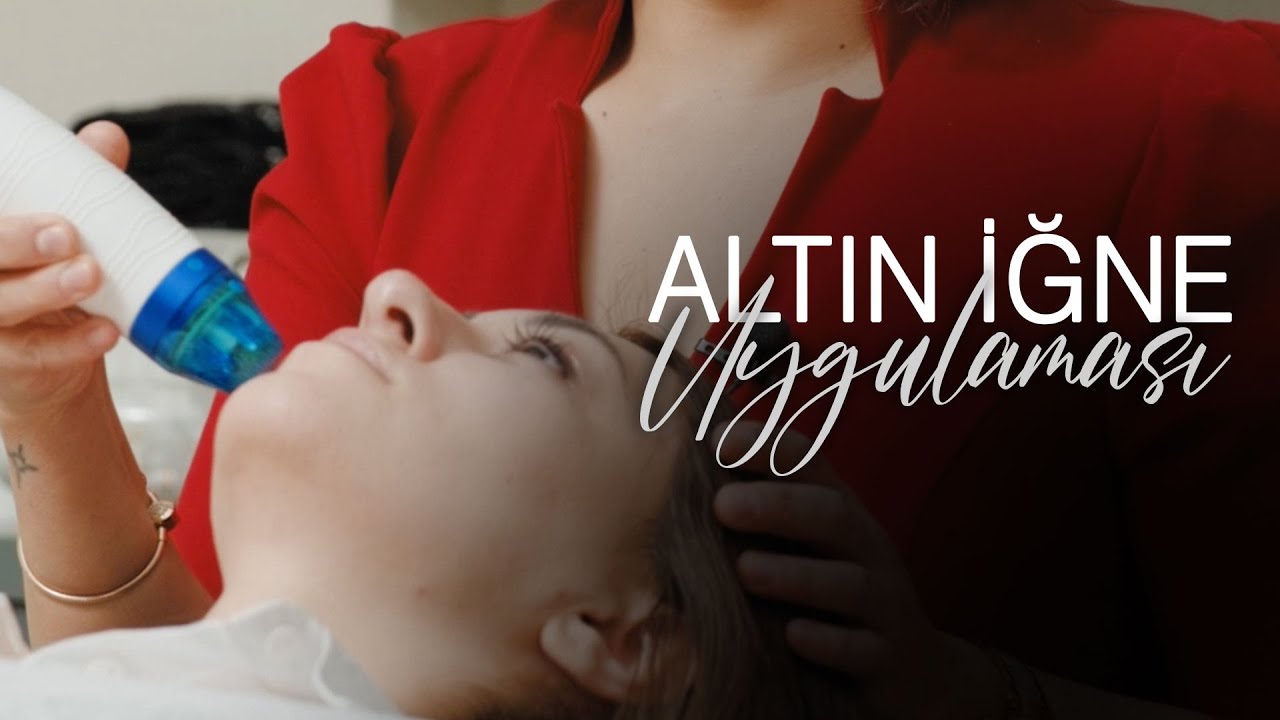 RADYO FREKANS ALTIN İĞNELEME