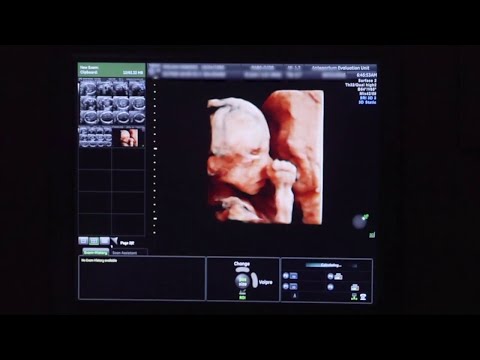 CT & Maternal Healthcare Options