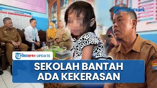 Siswinya Viral seusai Alami Mata Lebam, Kepsek Bantah Ada Kekerasan: Kita Ikuti Saja Prosedurnya