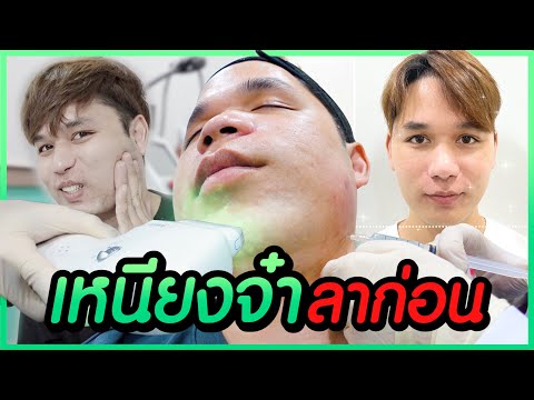 เมโสแฟต ยี่ห้อไหนดี