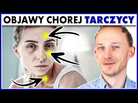 Oznaki, że tarczyca ma kłopoty - i jak jej pomóc! Nadczynność tarczycy | Dr Bartek Kulczyński