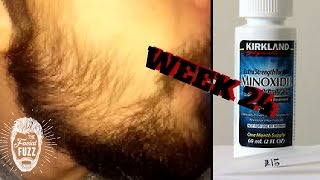 Minoxidil Beard | Week 24 | The Experiment | #Facialfuzzfridays