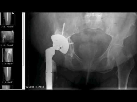 Xray tech note w additional images obtained