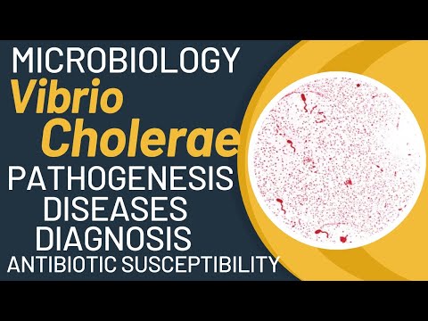Vibrio cholerae cholera | Vibrio cholerae microbiology | Pathogenesis, lab diagnosis