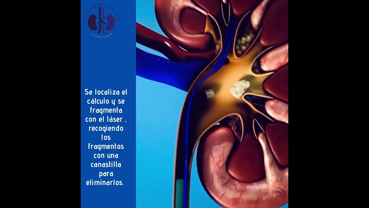 Irving Reyna Blanco-16