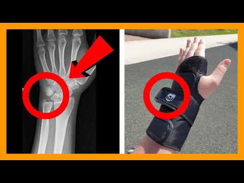 I Nearly BROKE My Wrist! + Vertical Anamorphic Setup