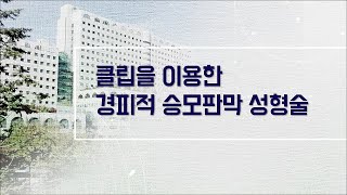 클립을 이용한 경피적 승모판막 성형술 미리보기