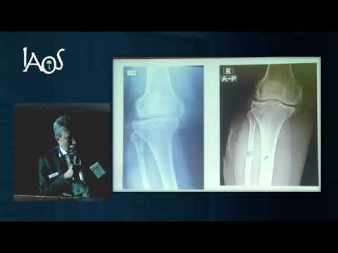 download lagu mp3 mp4 Dr L Prakash, download lagu Dr L Prakash gratis, unduh video klip Dr L Prakash