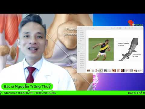 Bật mí, Đứt Dây Chằng Đầu Gối - ACL cách nhận biết | Bác sĩ Thể thao Nguyễn Trọng Thuỷ