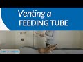 How To Vent A Feeding Tube AboutKidsHealth At The Hospital For Sick Children