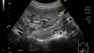 Ultrasound Video showing the fetus who was attempted for abortion.