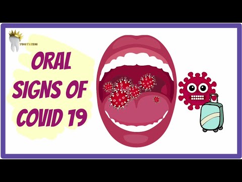 Dlaczego objawy COVID-19 występują w jamie ustnej?