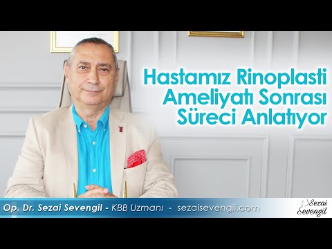 Hastamız Rinoplasti Ameliyatı Sonrası Süreci Anlatıyor | Op. Dr. Sezai Sevengil - KBB Uzmanı