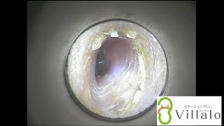 耳掃除動画vol.５「痒くてもう我慢できない」